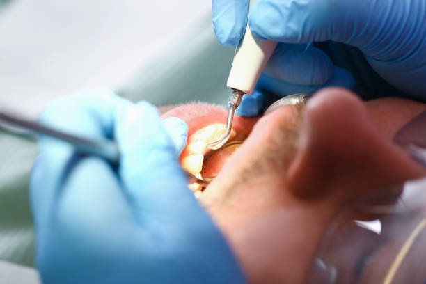 Best Emergency Cosmetic Dentistry in White Cloud, MI
