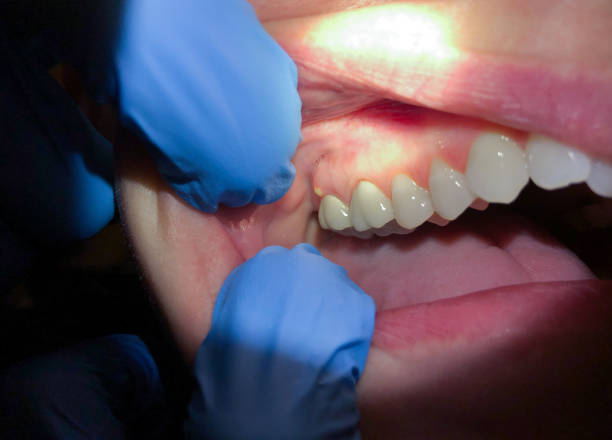 Best Emergency Dentist for Special Needs Patients in White Cloud, MI